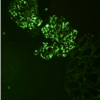 Immunofluorescent staining in C3 glomerulopathy